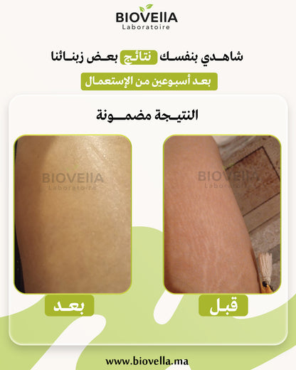 Pack Anti-Vergetures باك علاج التشققات