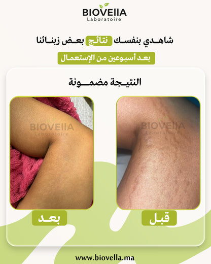 Pack Anti-Vergetures باك علاج التشققات