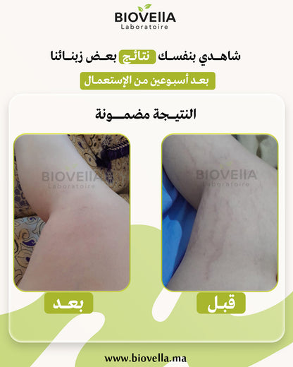 Pack Anti-Vergetures باك علاج التشققات