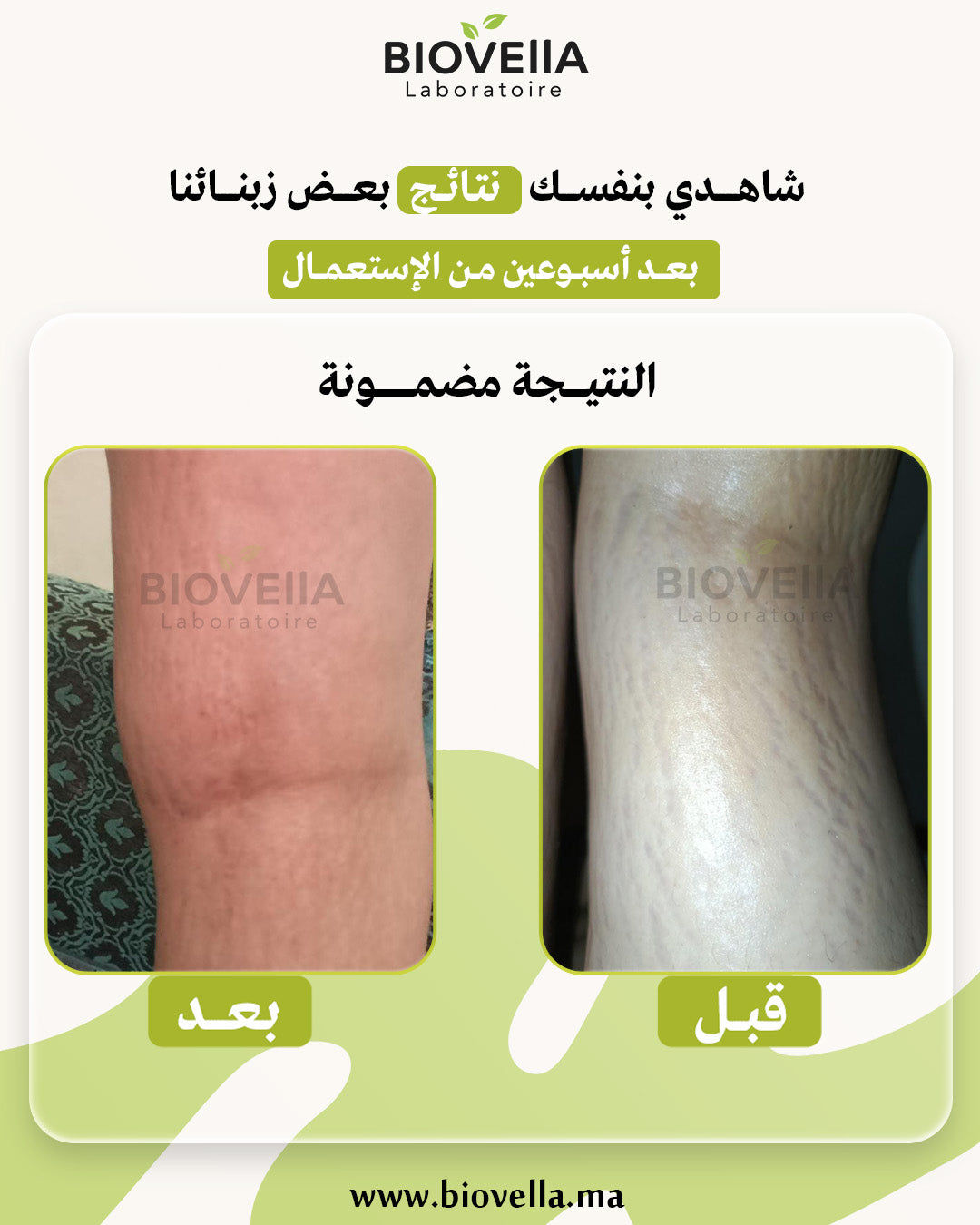 Pack Anti-Vergetures باك علاج التشققات