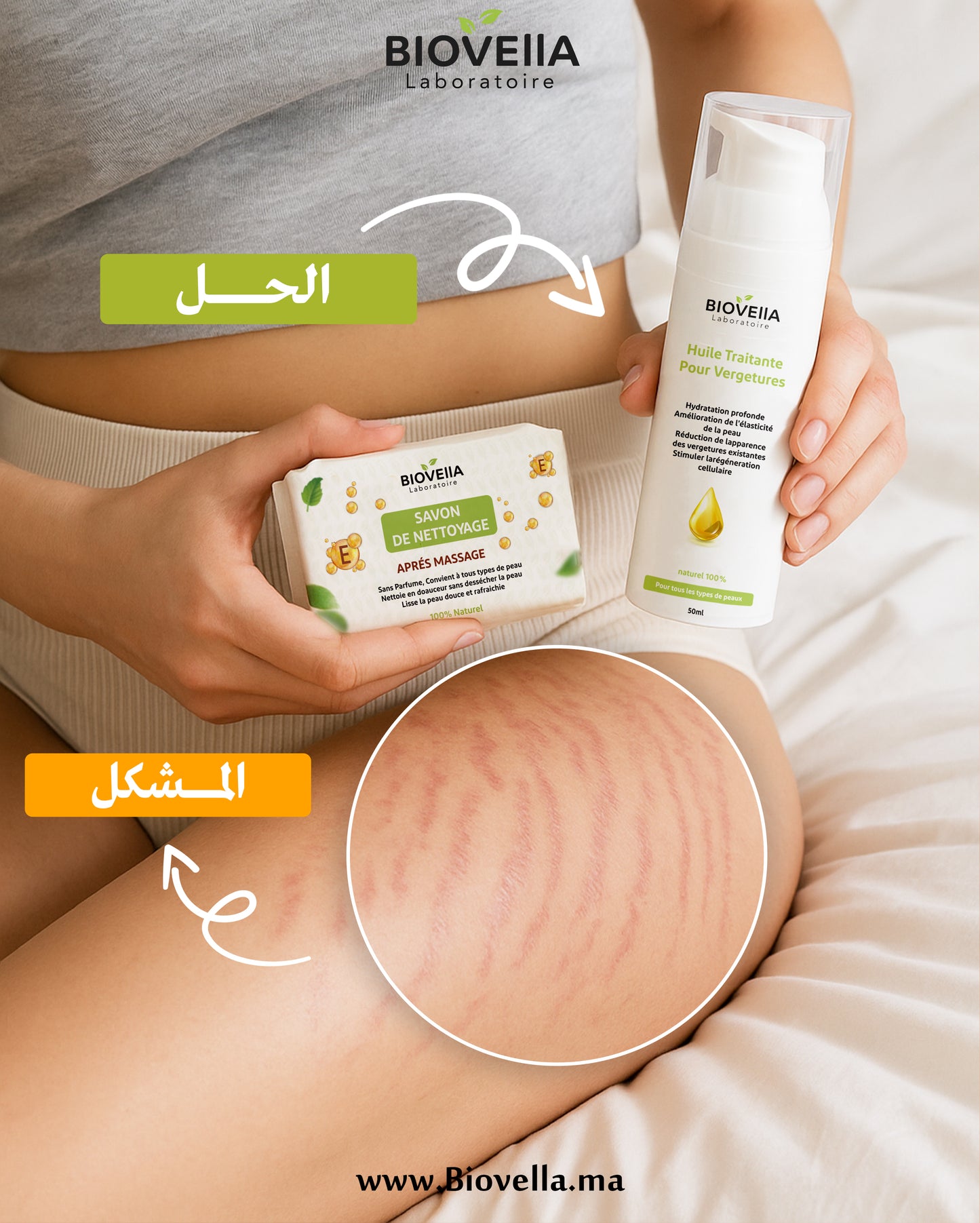 Pack complet anti-vergetures