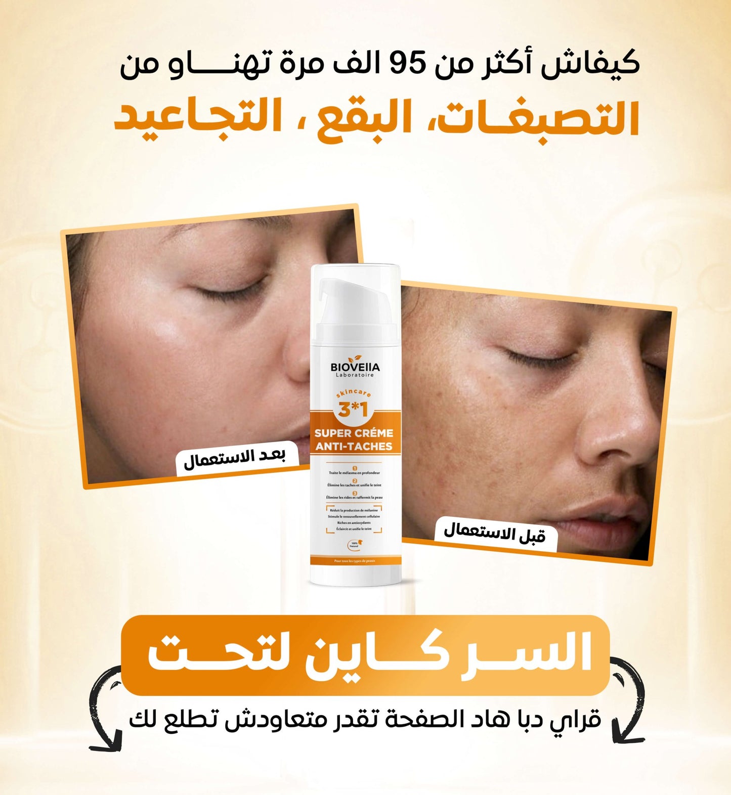 Super Crème Anti - Taches - Biovella - soin naturel anti - vergetures